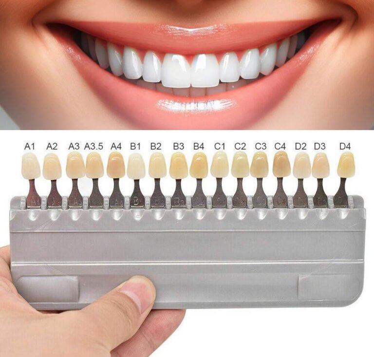 A natural color chart displaying various shades of dental veneers, ranging from light to dark.