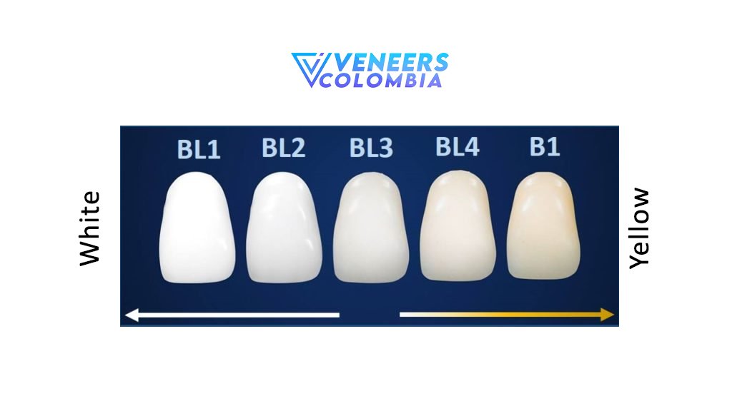 A dental veneers color chart showing shades from B1, BL2, etc., arranged in a gradient for easy selection of natural-looking veneer colors.