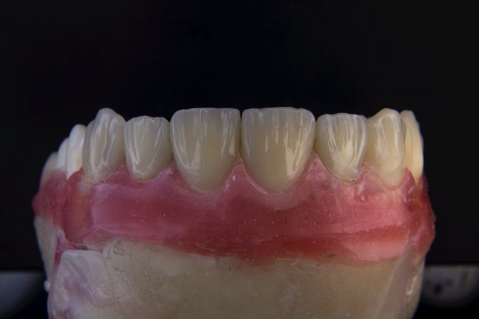 a close up of a tooth with gumpaste on it