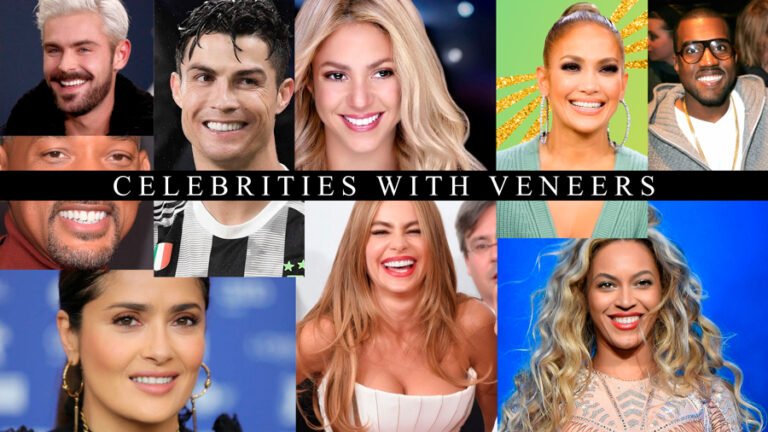 celebrities with veneers