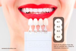 Close-up of a woman's smile with red lipstick, showcasing BL1, BL2, BL3, and BL4 veneer shades. Text reads '8 out of 10 patients from the USA or Canada who come to Colombia choose BL1.' Visit veneerscolombia.com for more information