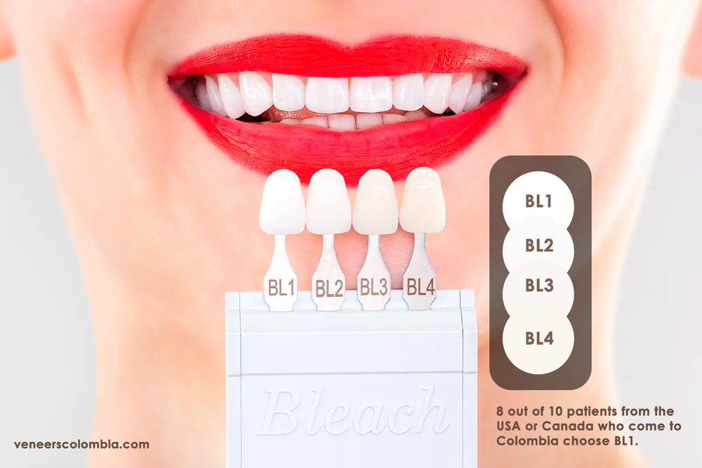 Close-up of a woman's smile with red lipstick, showcasing BL1, BL2, BL3, and BL4 veneer shades. Text reads '8 out of 10 patients from the USA or Canada who come to Colombia choose BL1.' Visit veneerscolombia.com for more information