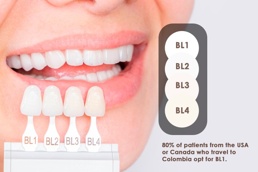 A close-up of a woman's smile, highlighting the veneer shades BL1, BL2, BL3, and BL4. The text states, "80% of patients from the USA or Canada who travel to Colombia opt for BL1."